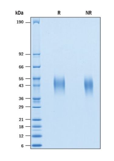 2 μg/lane Protein was resolved with SDS-PAGE under reducing (R) and non-reducing (NR) conditions and visualized by Coomassie® Blue staining.